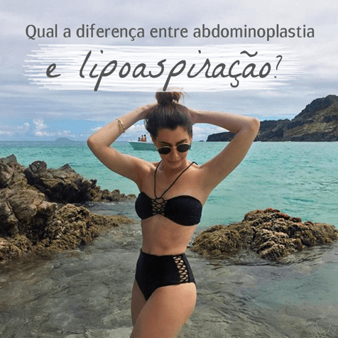 diferença entre abdominoplastia e lipoaspiração