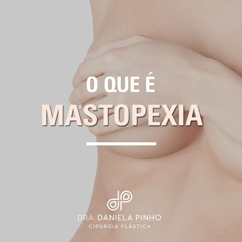 mastopexia (lifting de mamas)